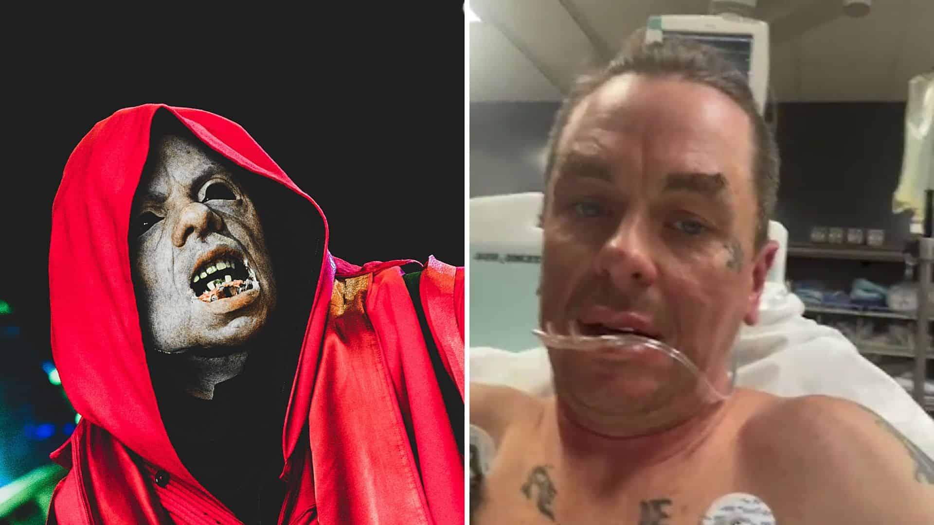 Sid Wilson Burn Injury